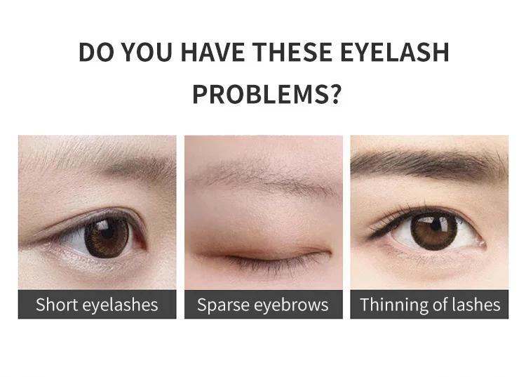 Fast Eyebrow Growth Serum Eyelash Hair Growth Anti Hairs Loss Product Prevent Baldness Fuller Thicker Lengthening Eyebrow Makeup Fast Eyebrow Growth Serum Eyelash Hair Growth Anti Hairs Loss Product Prevent Baldness Fuller Thicker Lengthening Eyebrow Makeup