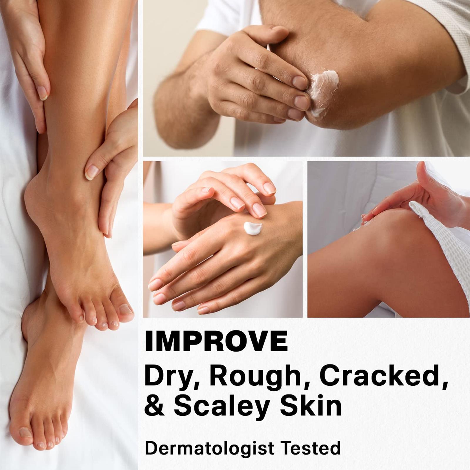 45% Urea + 2% Salicylic Acid Foot Cream, Intensive Moisturizing Care for Dry, Cracked Skin, Hydrating Foot & Hand Cream for Women & Men