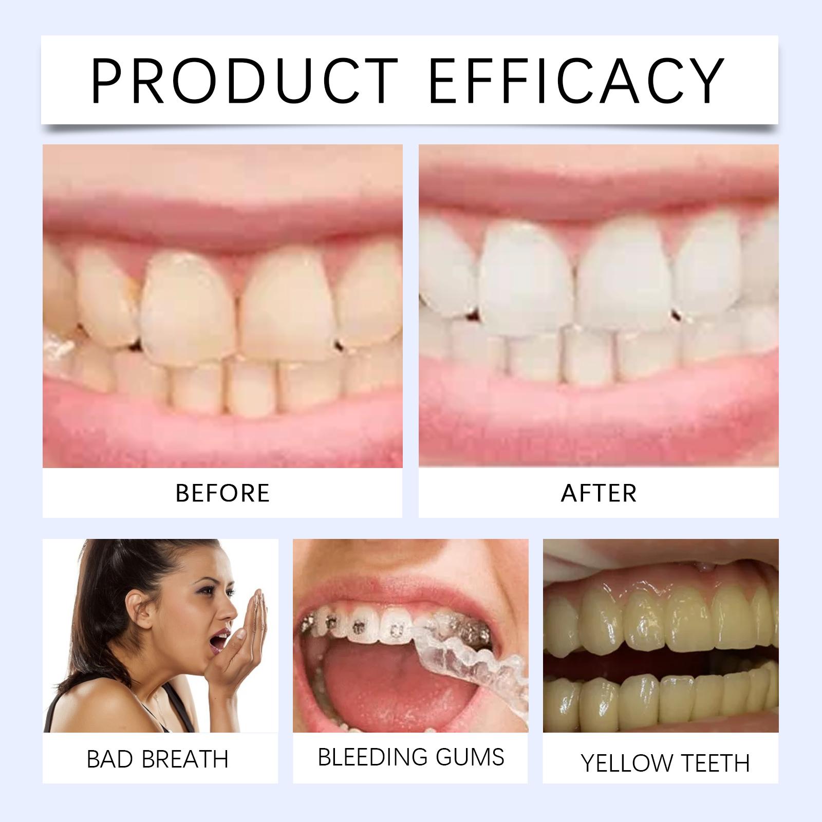 Oralhoe Denture Cleaning Effervescent Tablets with Lemon & Mint Extracts for Fresh Breath Stain Removal & Bacteria Killing 12 Pieces tooth repair kit whiten session interdental filling fake teeths instant confidence perfect smile gems enhances aesthetic