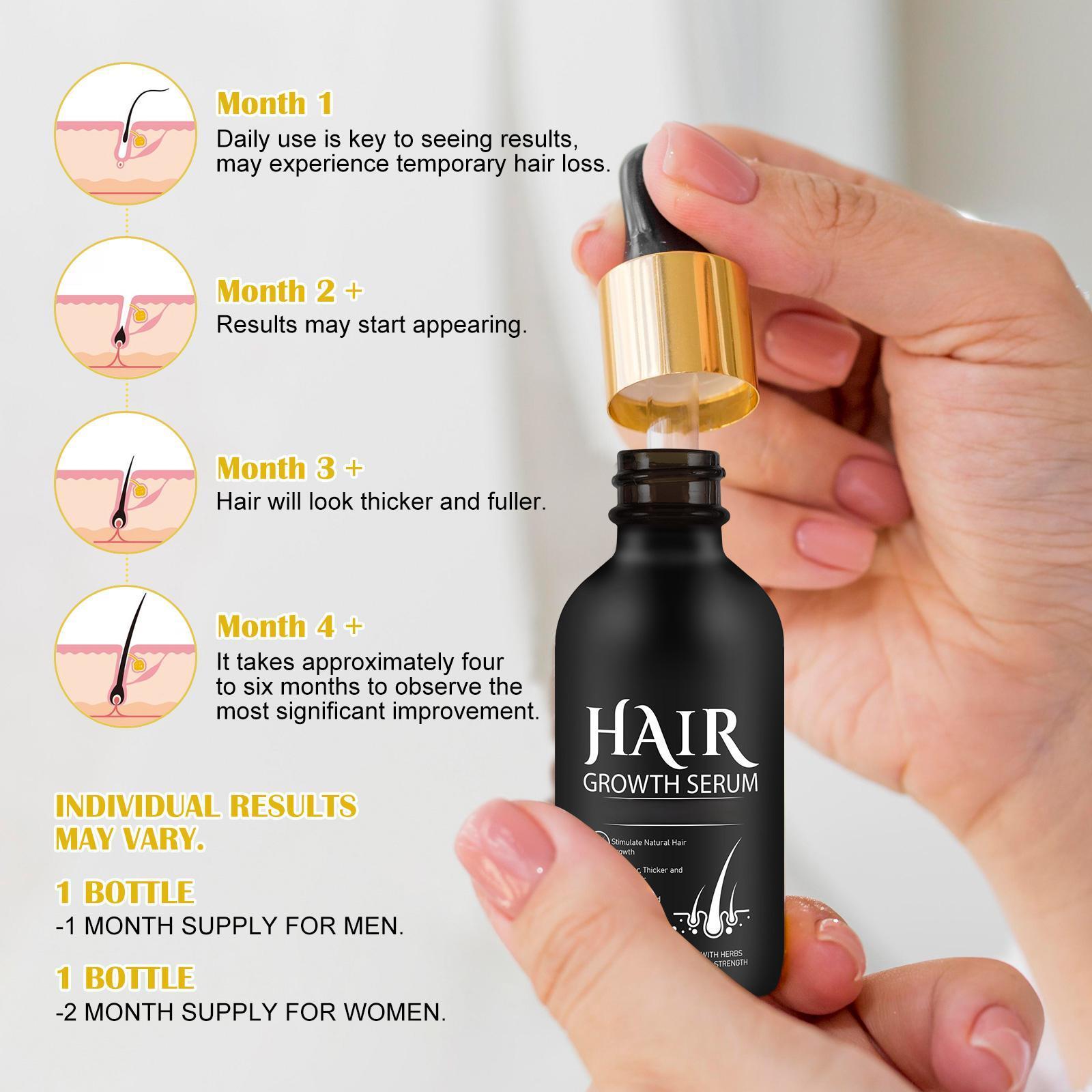 Hair Growth Oil for Men and Women - Regrowth Serum, Extra Strength Spray for Hair Loss, Thicker Healthier Hair, Beard Growth Kit, Topical Treatment, 2.02 oz