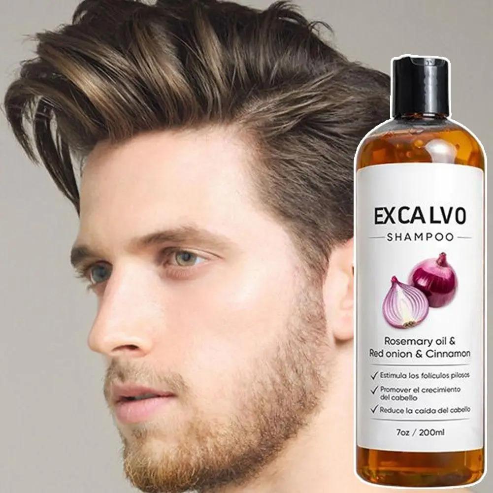 Rosemary Hair Shampoo Red Onion Extract Anti Hair Loss Nourish Follicle Oil Control Clean Scalp Soft Smooth Hair