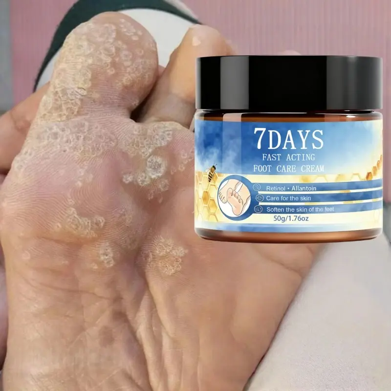 7-Day Foot Care Cream, Anti-Crack Foot Balm, Foot Moisturizer, Moisturizing, Nourishing, Softening, Ideal for Dry Cracked Feet, Skin Conditioner, Gift