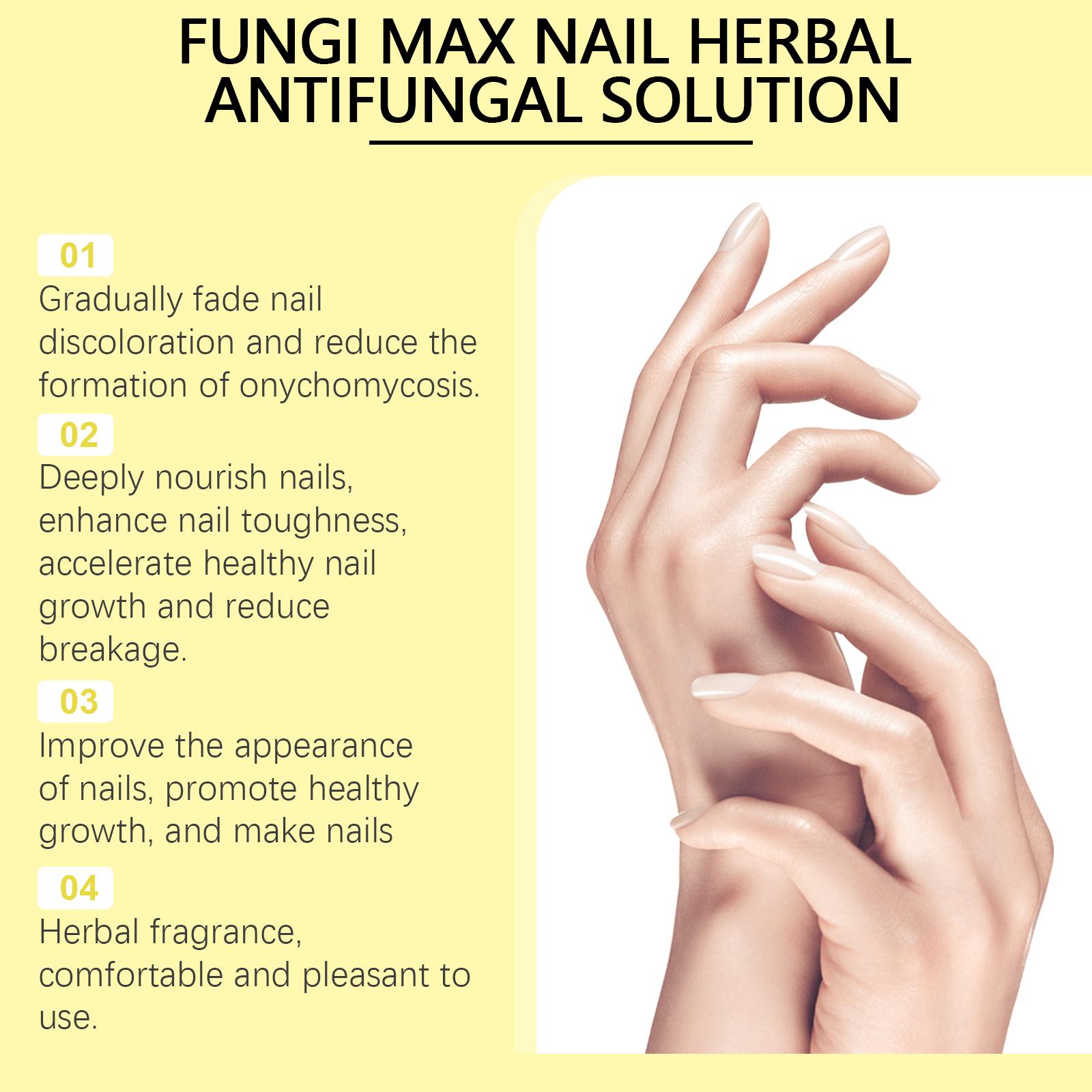 Ximonth Herbal Nail Care Solution Hand, Foot And Nail Cleansing And Repair Bright Nail Thick Toe Care Solution