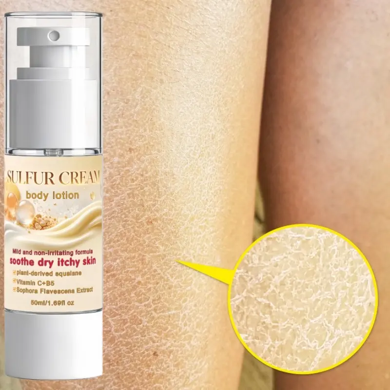 moisturizing  Body Lotion with botanical squalane Vitamin C B5 Sophora Flavescens Extract, Mild Hydrating Body Moisturizer Cream for Dry Itchy Skin, Long Lasting Nourish Skin Restore Smooth Glow, Daily Skin Care Body Cream for All Skin Types