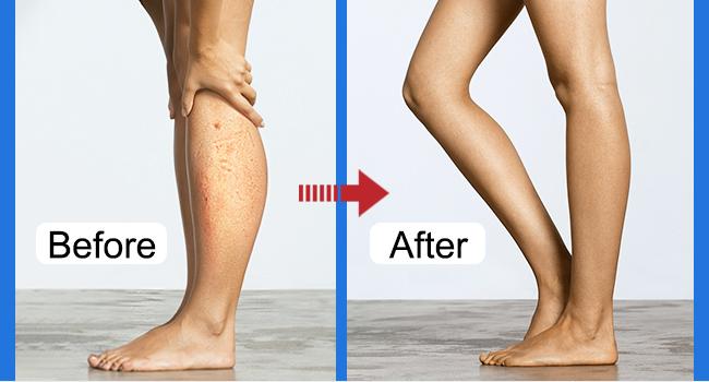 Compression Socks for Women & Men 4 Pairs, Best Support for Nurses Running Travel Compression Socks for Women & Men 4 Pairs, Best Support for Nurses Running Travel